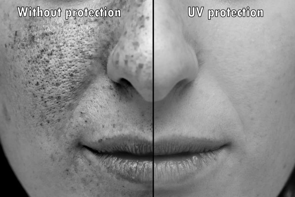 Is UV Damage Permanent?